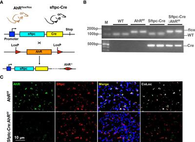 Type II alveolar epithelial cell aryl hydrocarbon receptor protects against allergic airway inflammation through controlling cell autophagy